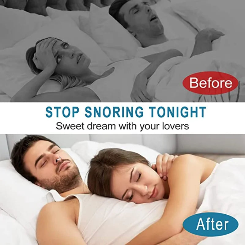 Brezyn™ 2 Anti-Snoring Nasal Device 